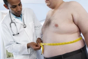 Preoperative Preparations for Bariatric Surgery